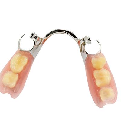 Close-up of partial dentures