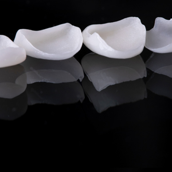 Four veneers in Little Elm sitting in a row on a black surface