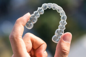 Can You Fix An Overbite With Invisalign?
