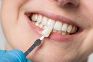 Woman smiling as dentist holds up a dental veneer