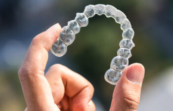Can You Fix An Overbite With Invisalign? Frisco, TX